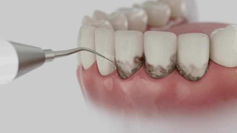 Trusted Invisalign Clear Aligners service in Pomeroy, WA - Dentist Open Now